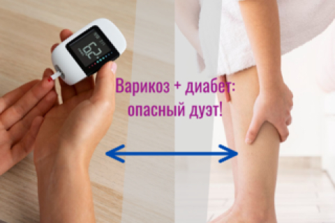 Варикоз + диабет: опасный дуэт!